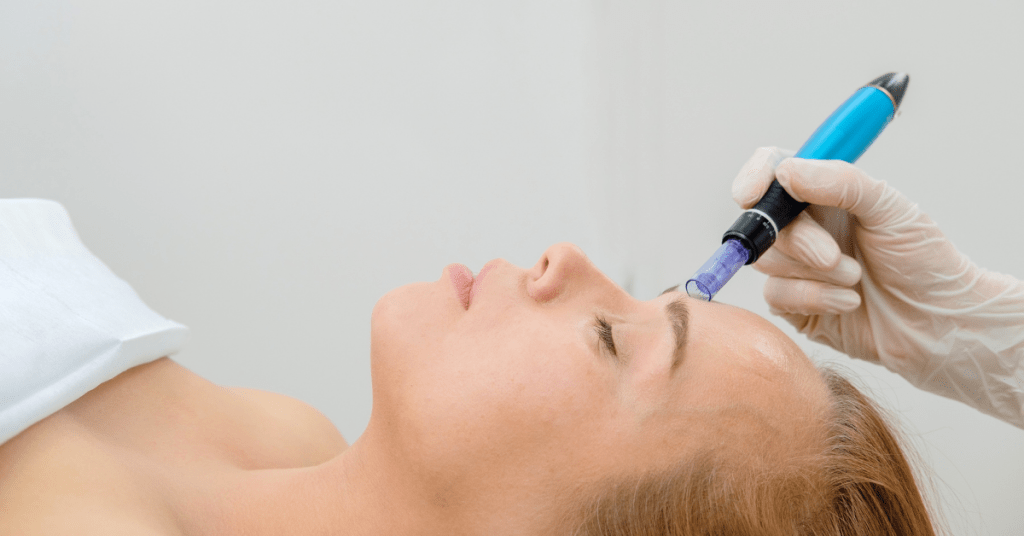 Solution of skin Dr pen UK
