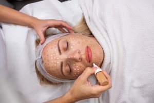 BB Glow with Dr Pen