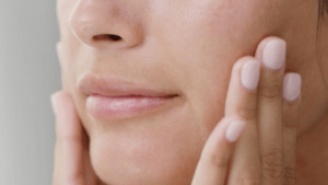Common Skin Issues and How Microneedling Helps